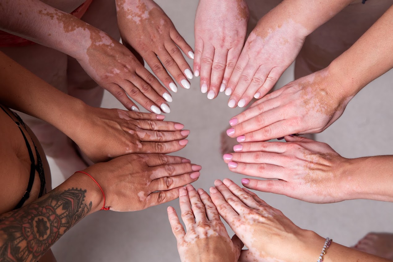 You are currently viewing Bielactwo bez tabu. Manifest kobiecej siły