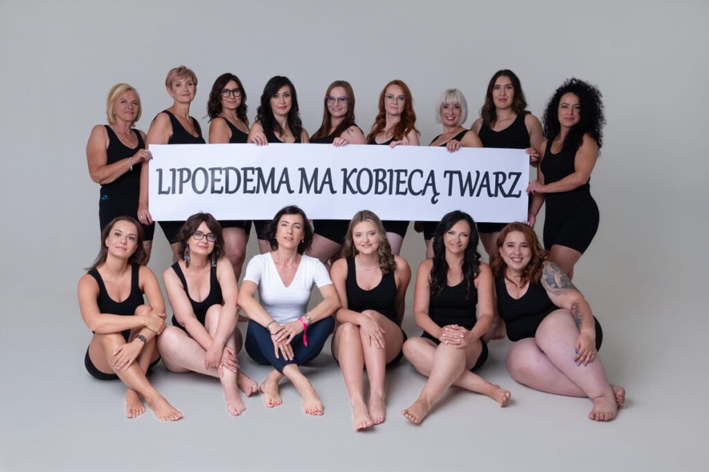 „Lipoedema ma kobiecą twarz”